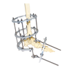 Complex oot Deformity Ilizarov Fixator