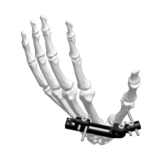 Mini External Fixator (Right-angle type)