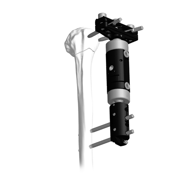 Lower Limb Micromotion External Fixator (T-type)