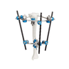Proximal Tibia External Fixator II