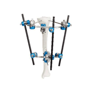 Proximal Tibia External Fixator II