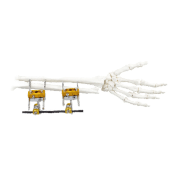 Ulna&Radius External Fixator