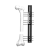 Reconstruction External Fixator (Limb-extension type)
