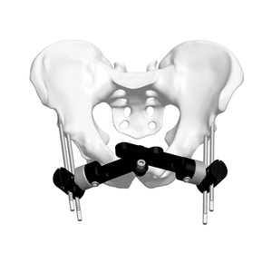 Pelvic External Fixator (Double strand)