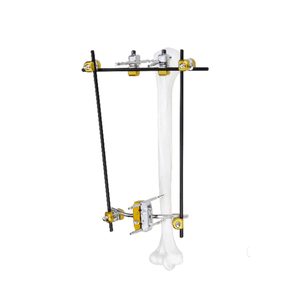 Proximal Humerus External Fixator