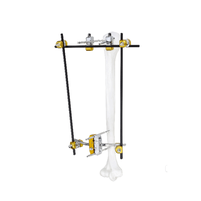 Proximal Humerus External Fixator