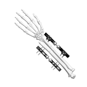 Wrist External Fixator (Tractive-type)