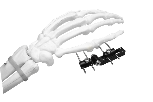 Mini External Fixator (Horizontal axis)