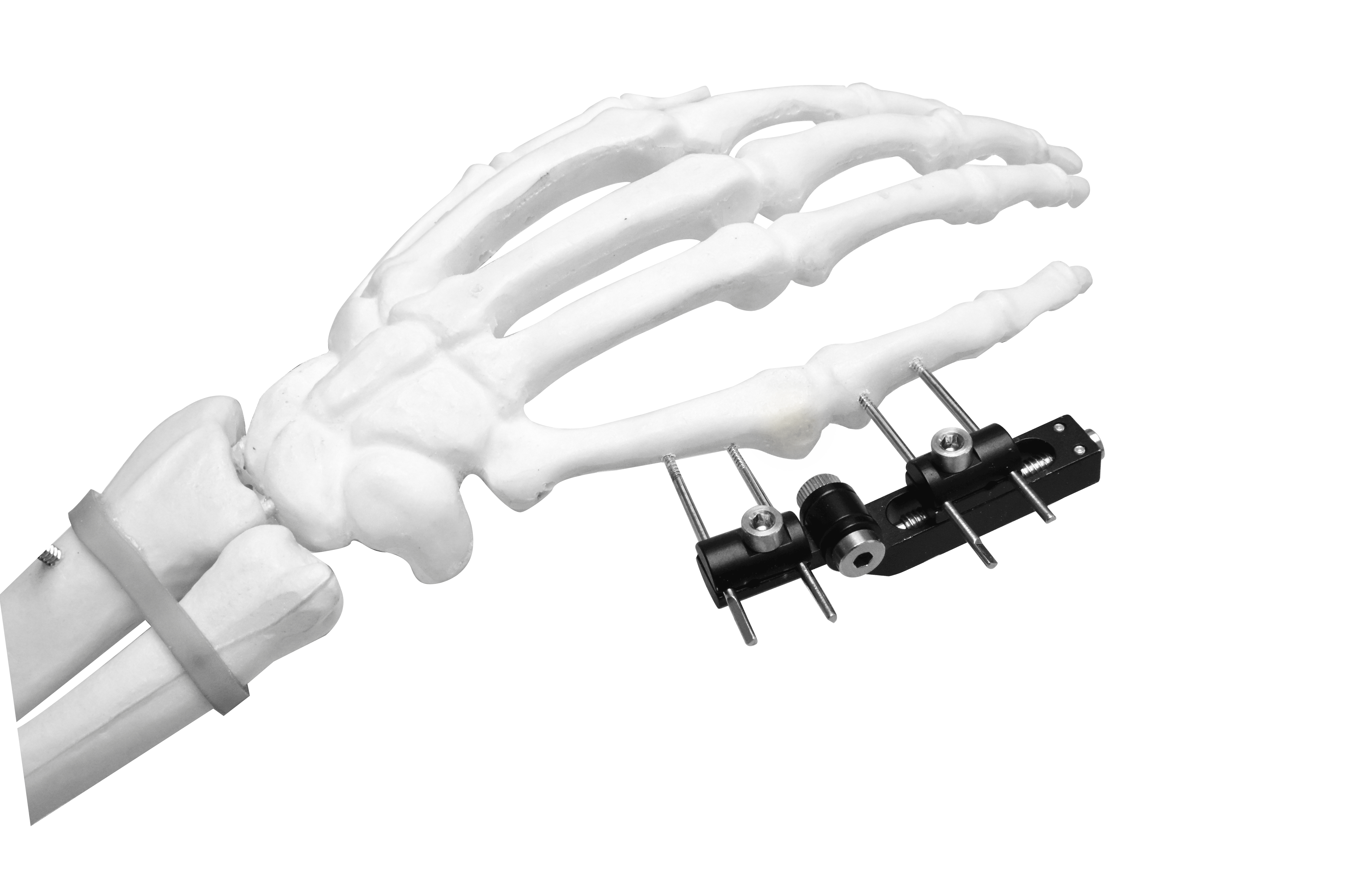 Mini External Fixator (Horizontal axis)
