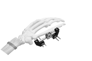 Mini External Fixator (L-type)