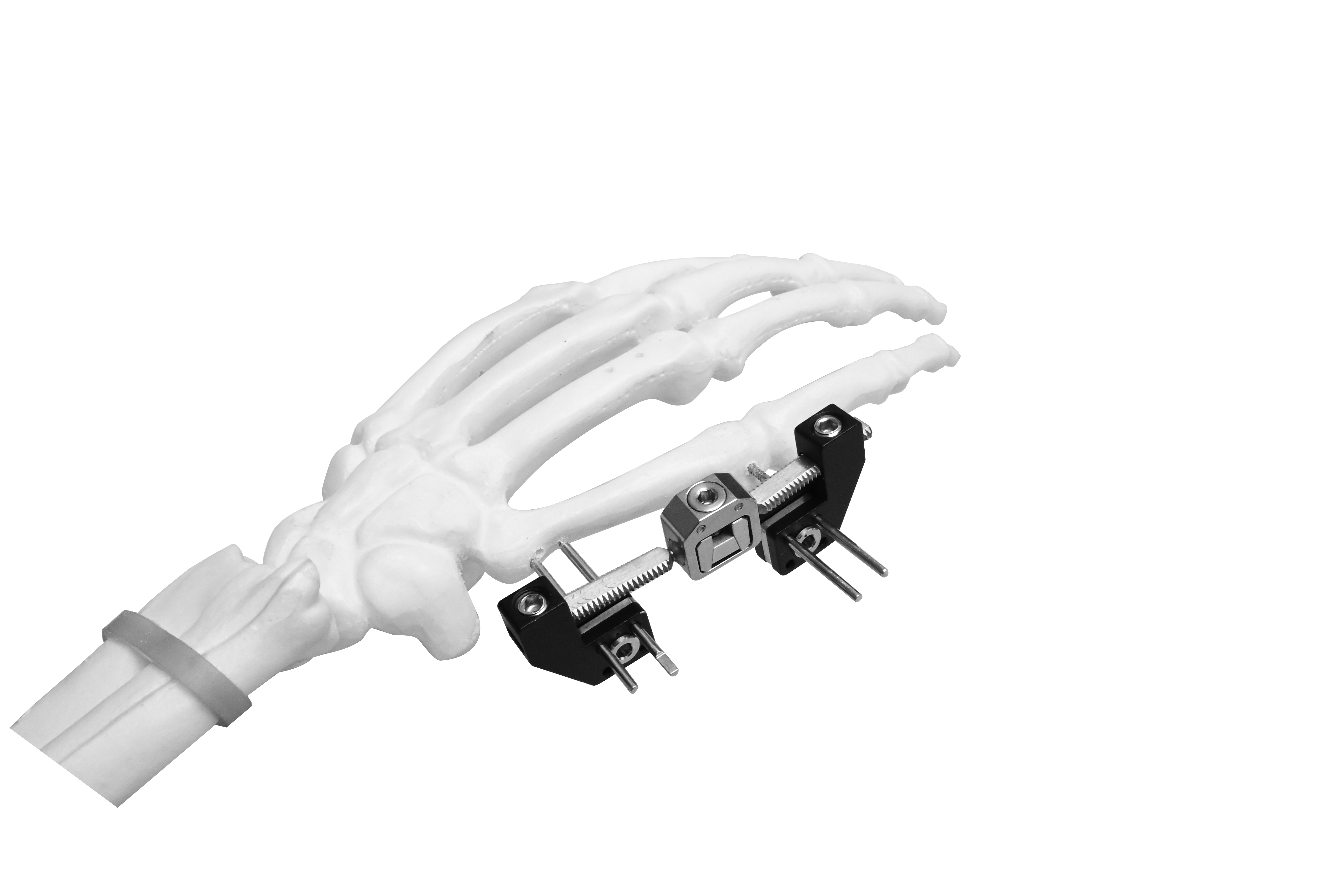 Mini External Fixator (L-type)