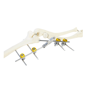 Elbow External Fixator (Integrated)