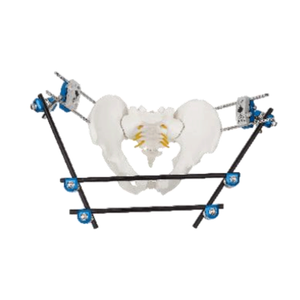 Pelvic External Fixator
