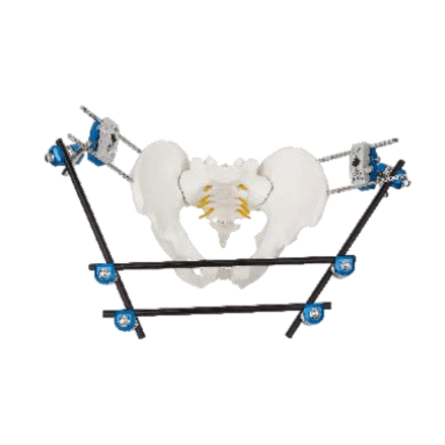 Pelvic External Fixator