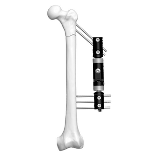 Lower Limb Micromotion External Fixator (Intertrochanteric T-type)