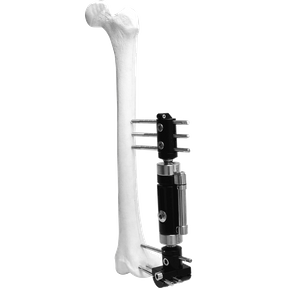 Lower Limb Micromotion External Fixator (Lengthened T-type)