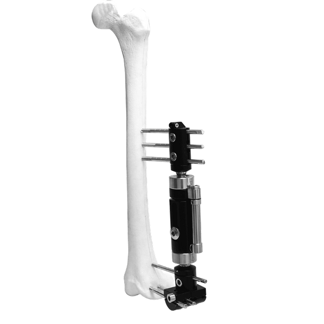 Lower Limb Micromotion External Fixator (Lengthened T-type)