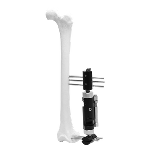 Lower Limb Micromotion External Fixator (T-type)