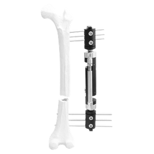 Lower Limb Micromotion External Fixator (Straight type)