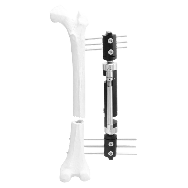 Lower Limb Micromotion External Fixator (Straight type)