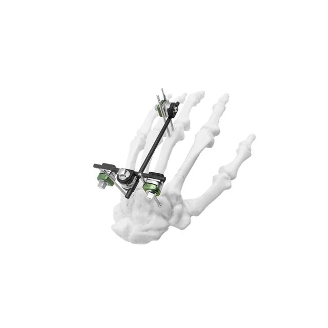 Mini External Fixator II