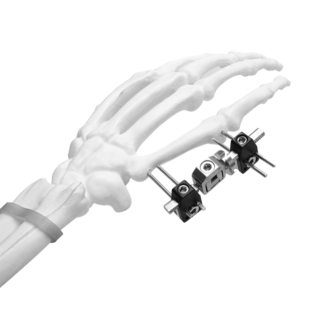 Mini External Fixator (Straight-type)