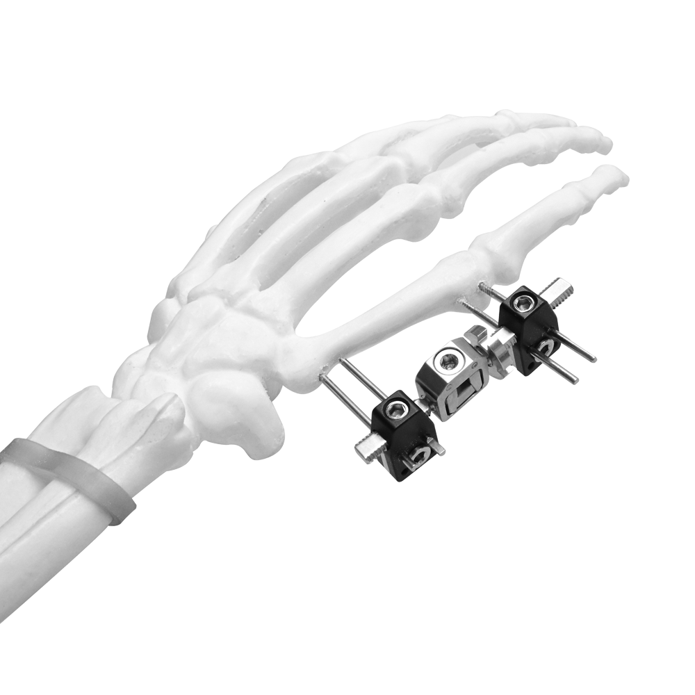 Mini External Fixator (Straight type)