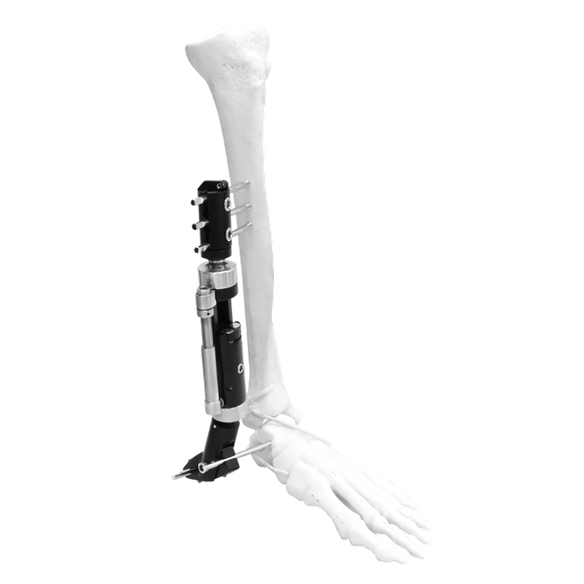 Lower Limb Micromotion External Fixator (Ankle type)