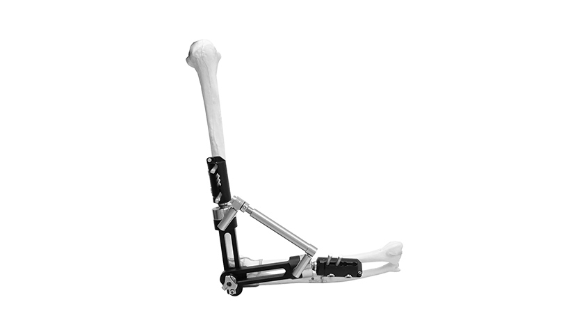 elbow-external-fixator elbow-external-fixator