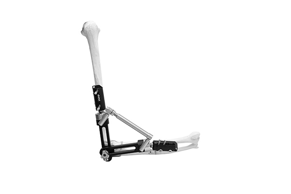 Elbow External Fixator