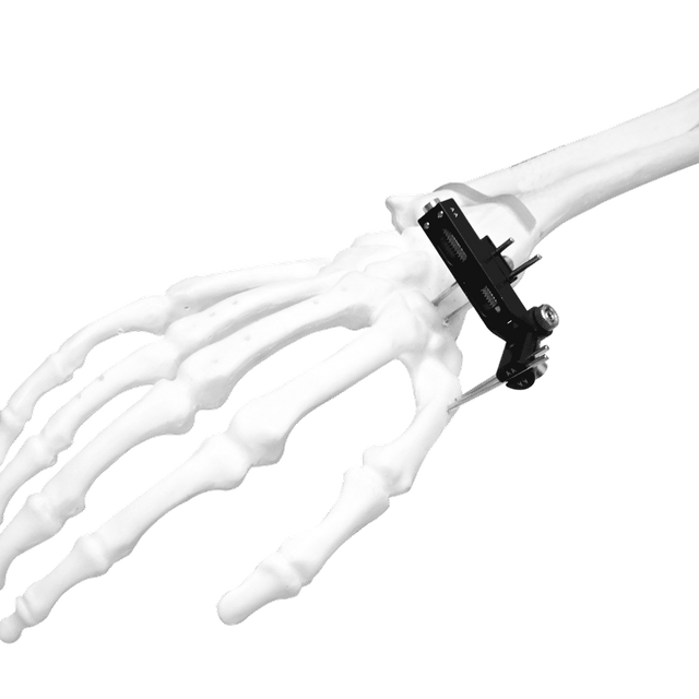 Mini External Fixator (Angle type)