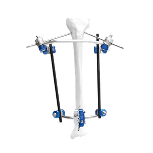 Proximal Tibia External Fixator II