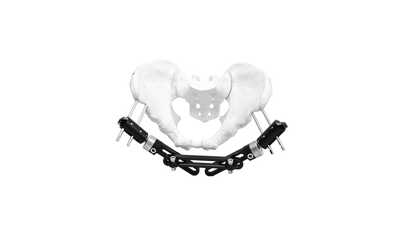 Premium Titanium Pelvic External Fixator for Emergency & Definitive Pelvic Fracture Treatment