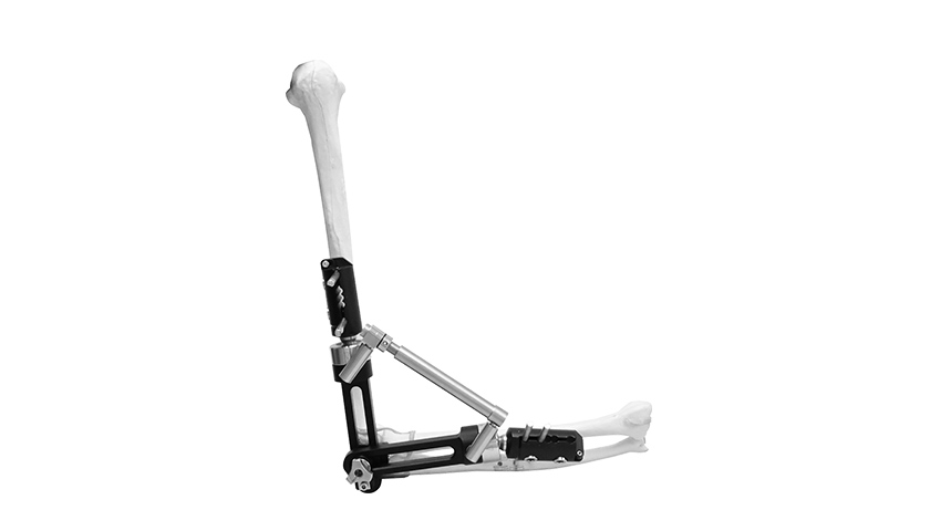 Wrist External Fixators Wrist External Fixators