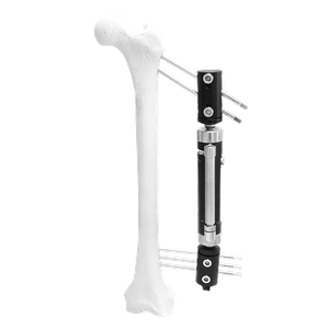 Lower Limb Micromotion External Fixator (Angled type)
