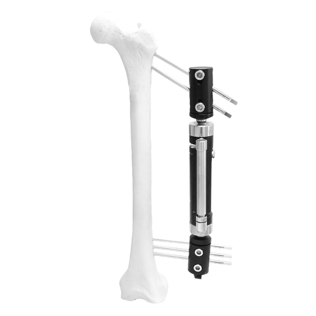 Lower Limb Micromotion External Fixator (Angled type)