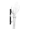 Wrist External Fixator