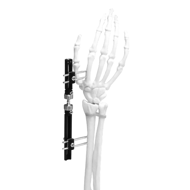 Wrist External Fixator