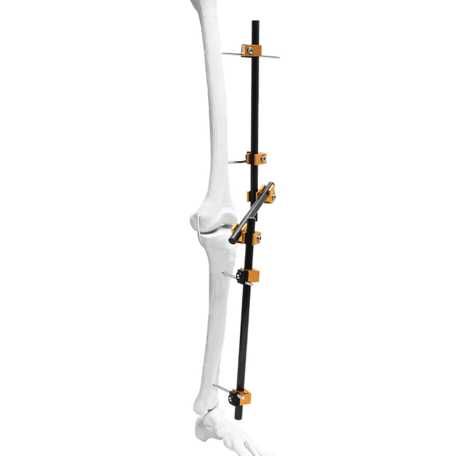 Prefix Knee External Fixator