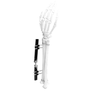 Wrist External Fixator