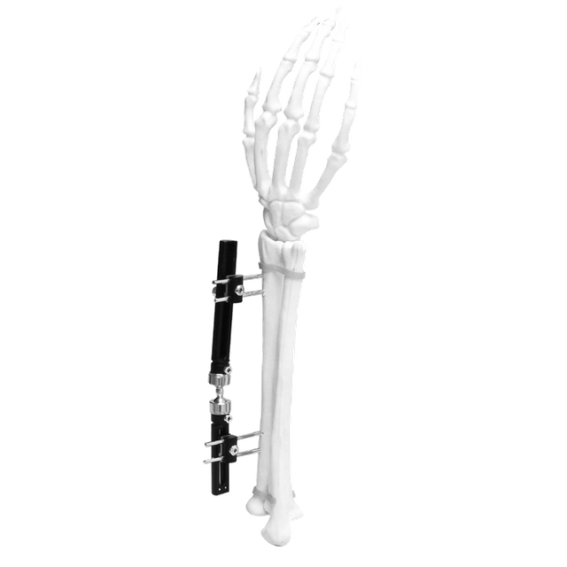 Wrist External Fixator
