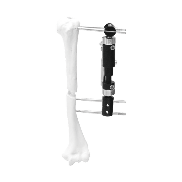 Paediatric Micromotion External Fixator (T-type)