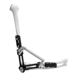 Elbow External Fixator