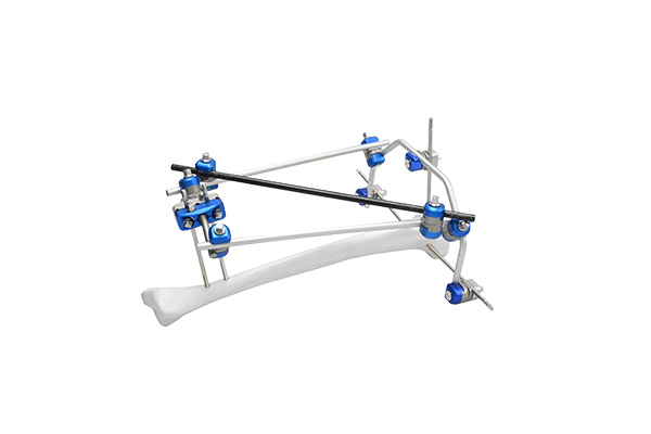 proximal-tibia-external-fixator