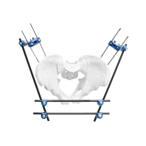 Pelvic External Fixator