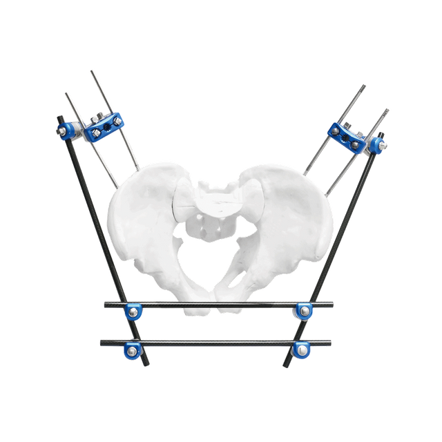 Pelvic External Fixator