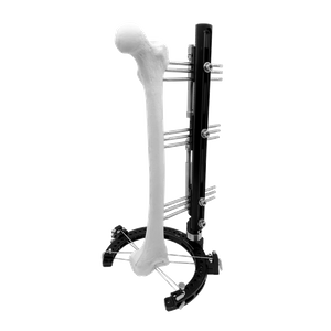 Hybrid Fixator Assembly For Reconstruction