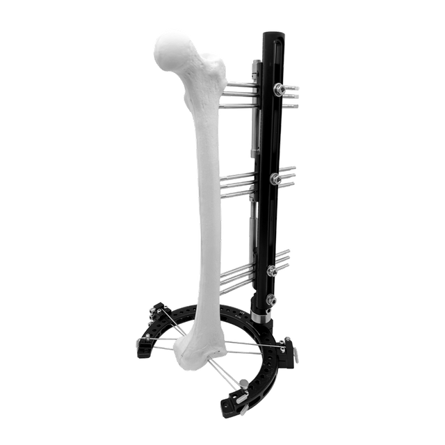 Hybrid Fixator Assembly For Reconstruction