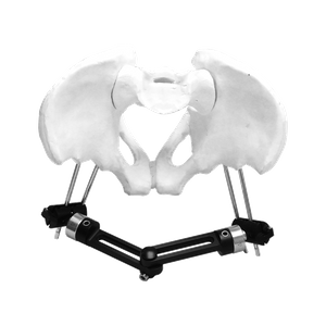 Pelvic External Fixator (Double strand)