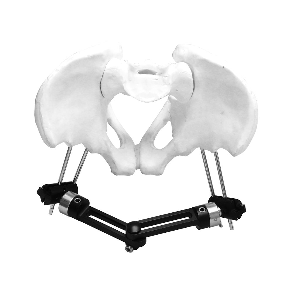 Pelvic External Fixator (Double strand)